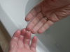 Zdjęcie dłoni osoby ze sparaliżowaną lewą ręką